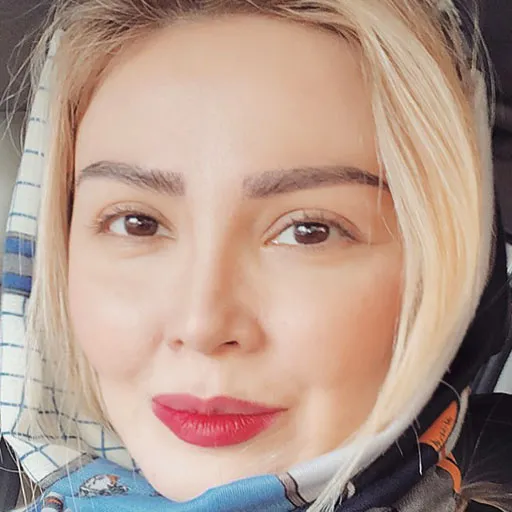 سپیده گلچین